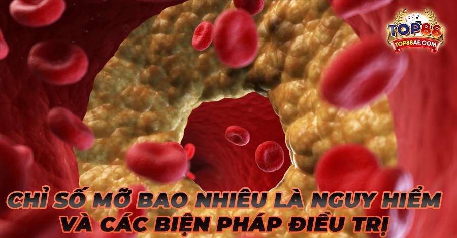 Chỉ số mỡ bao nhiêu là nguy hiểm và các biện pháp điều trị